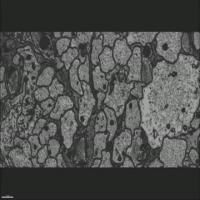 Axons & Glia in Spinal Cord