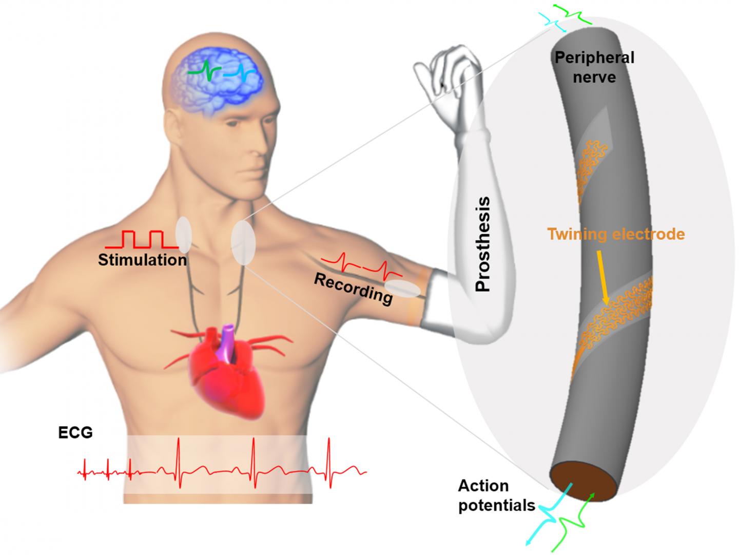 Climbing-inspired twining electrodes using shape memory for peripheral nerve stimulation and recording (1 of 6)
