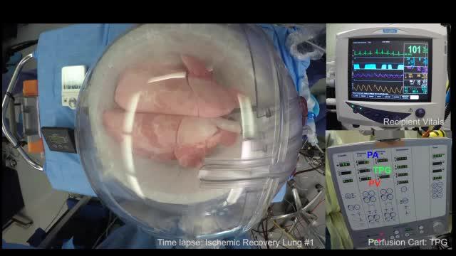Time-Lapse Footage