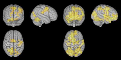 This is Your Brain on Meditation
