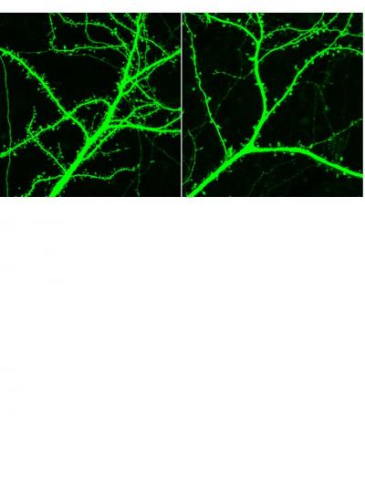 Traffic Jam in Brain
