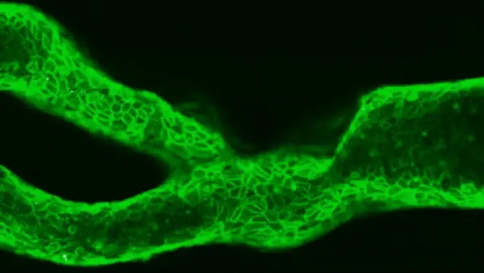 Microscopy video of 3D printed blood vessel coated in fibronectin(green) during an experiment. In one of the vessels you can see a blood clot forming (white)