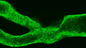 Microscopy video of 3D printed blood vessel coated in fibronectin(green) during an experiment. In one of the vessels you can see a blood clot forming (white)