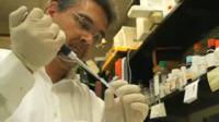 A Major Cause of Age-Related Memory Loss Identified (2 of 2)
