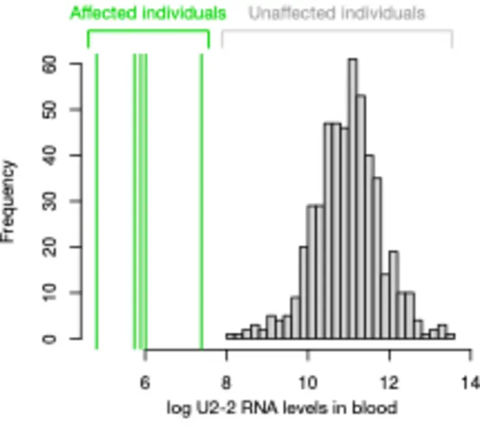 Researchers Identify the Most Common Recessive Neurodevelopmental Disorder Ever Discovered