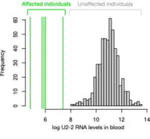 Researchers Identify the Most Common Recessive Neurodevelopmental Disorder Ever Discovered