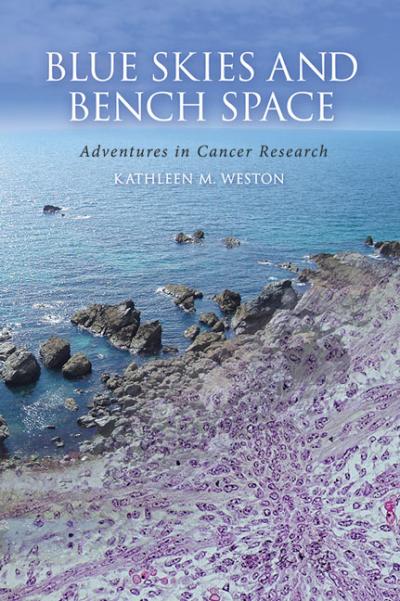 Blue Skies and Bench Space: Adventures in Cancer Research