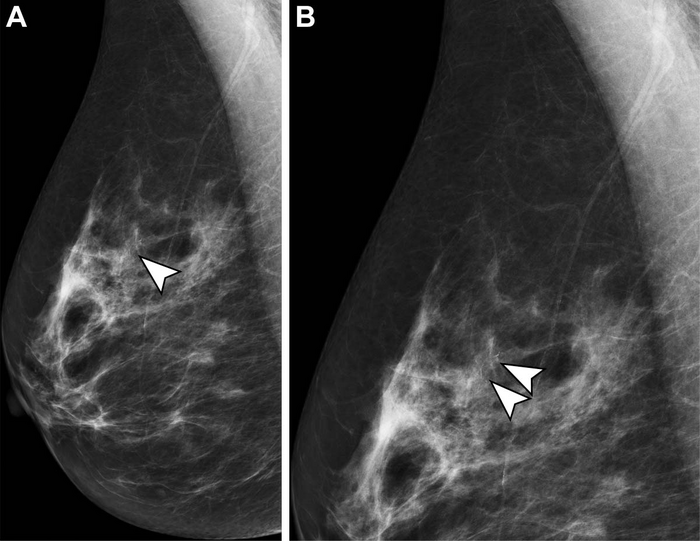 Trained Radiographers May Be a Solution for the Radiologist Shortage