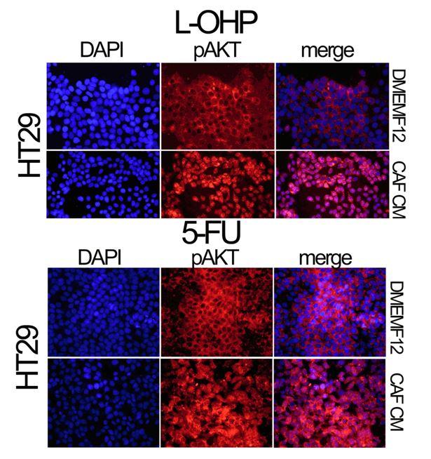 pAKT Immunofluorescence
