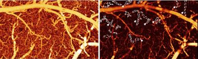 Comparison of Healthy vs. Cocaine-Induced Mouse Brain