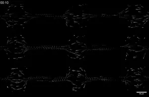 Video of bacterial invasion