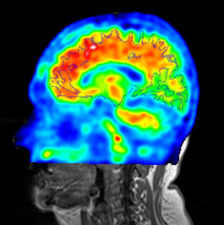 Brain Scans