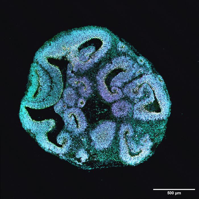 A human brain organoid.