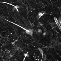 Nerve Cells Light Up As They Respond To Pain