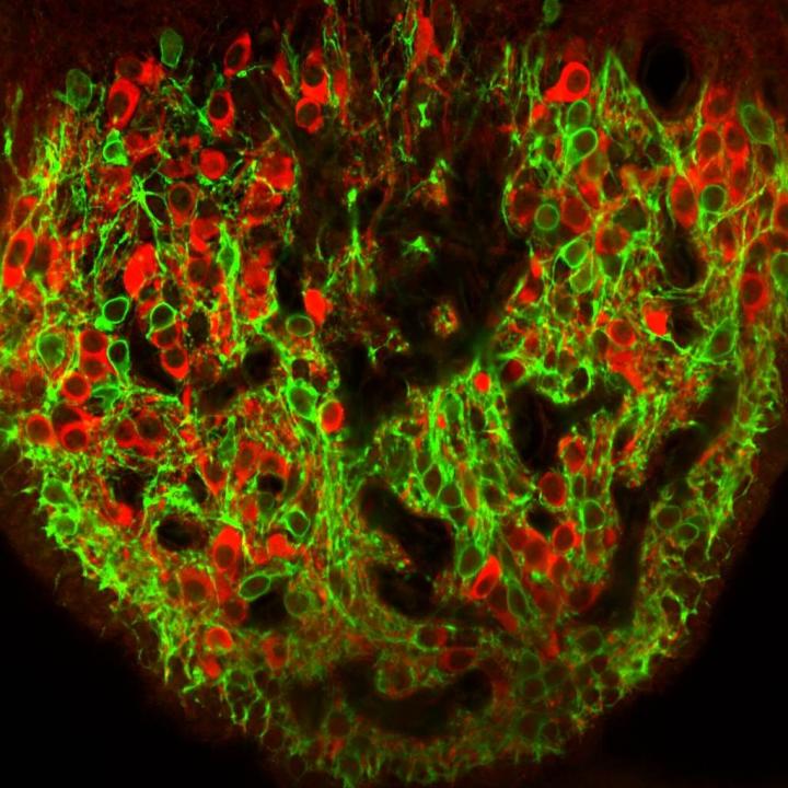 CUMC Researchers Have Identified 2 Types of Neurons that Control Thirst