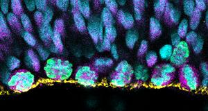Apical progenitor cells