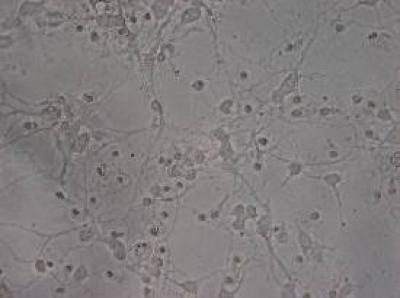Pre-hypoxic Neurons