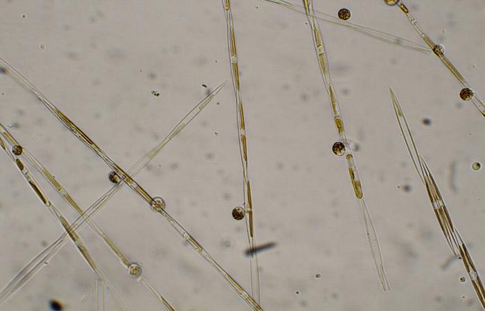 Toxic Algae <i>Pseudo-nitzschia</i>