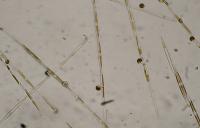 Toxic Algae <i>Pseudo-nitzschia</i>