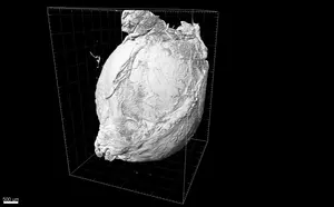5_Acumulación en tumor cuantificado por microscopía