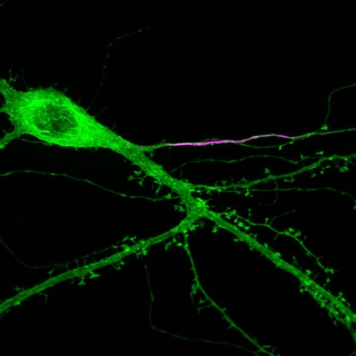 Cultured Hippocampal Dentate Granule Cell