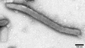 Ebolavirus in Negativkontrastierung