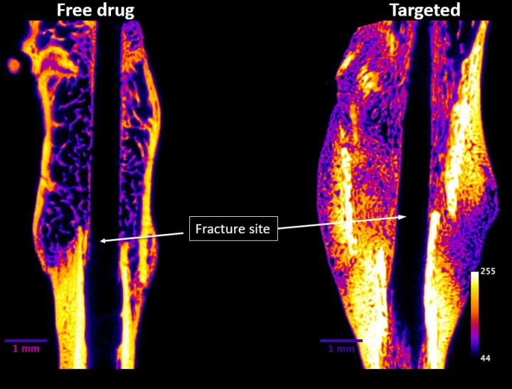 Novosteo Bone