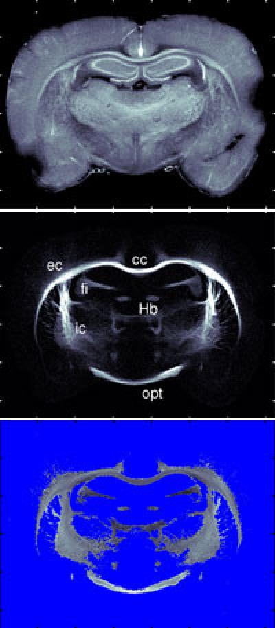 SAXS-CT Method