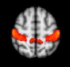 Somatosensory Cortex