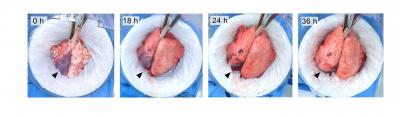 New Approach Shows Regeneration of Severely Damaged Lungs