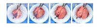 New Approach Shows Regeneration of Severely Damaged Lungs
