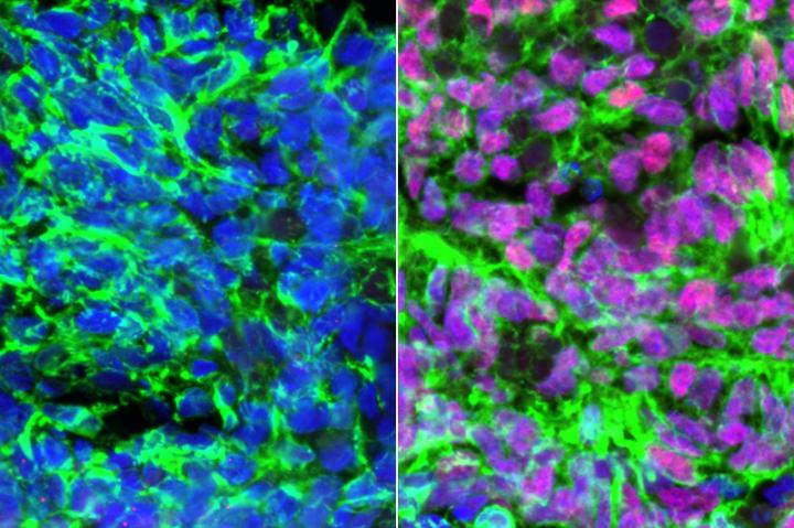 Creating Proprioceptive Sensory Interneurons