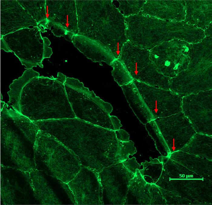 Closure of a small intercellular wound. The uncontracted actomyosin cable (green) can be seen surrounding the wound (red arrows) at the base of the lamellipodia as the lamellipodia advance. Image credit: Jocelyn Malamy