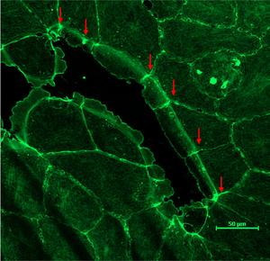 Closure of a small intercellular wound. The uncontracted actomyosin cable (green) can be seen surrounding the wound (red arrows) at the base of the lamellipodia as the lamellipodia advance. Image credit: Jocelyn Malamy