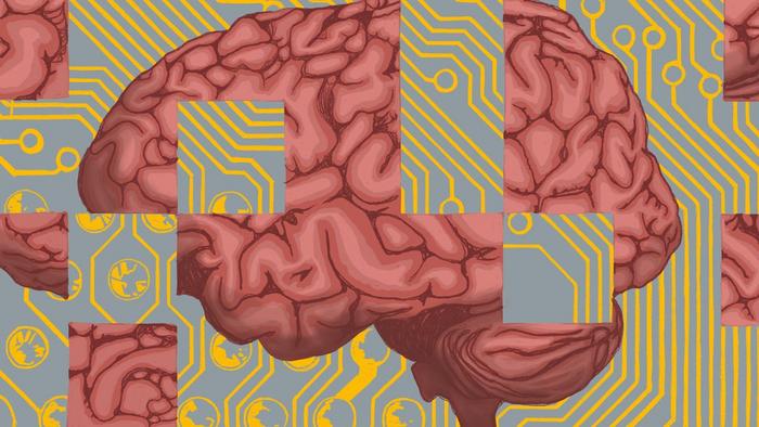 AlzheimersBrain