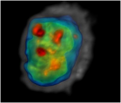 Computed Tomography Imaging of Esophageal Epithelial Cell