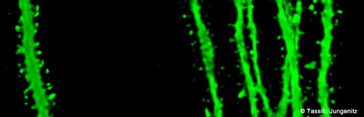 Dendrites