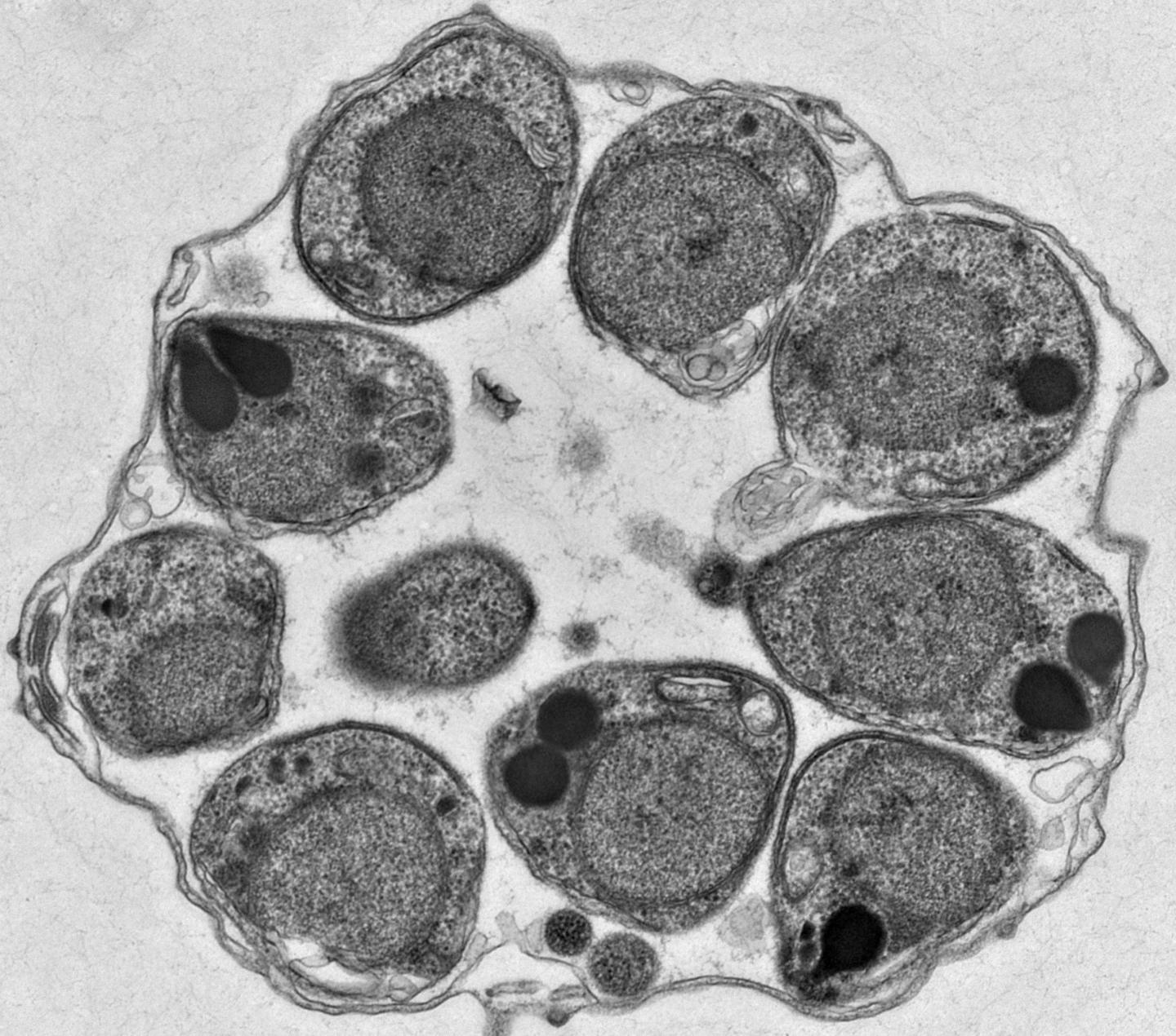 Solving a Malaria Mystery Identifies New Drug Targets (1 of 2)