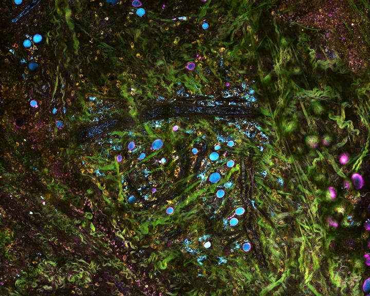 SLAM Microscopy