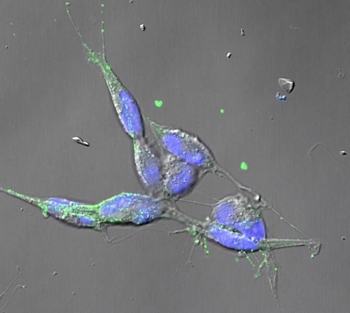 Neuroblastoma Cells