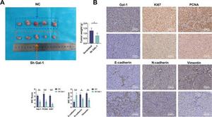 Targeting Gal-1 expression inhibits subcutaneous tumor growth.