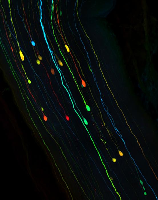 Neurons after traumatic brain injury