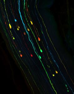 Neurons after traumatic brain injury