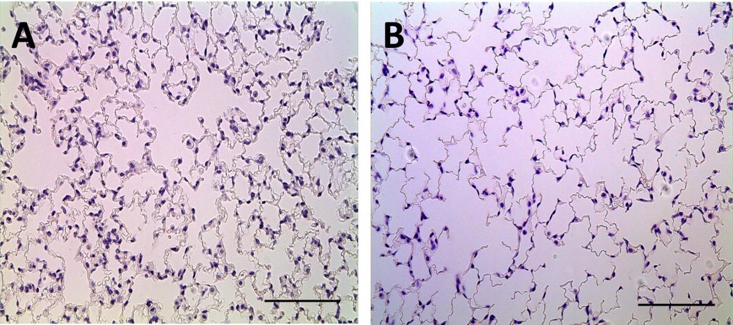 Lung Tissue