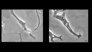 Supportive Materials Will Help Regenerate Heart Tissue