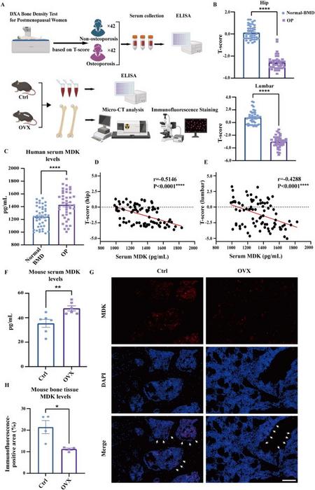 There is a negative correlation between serum MDK levels and BMD