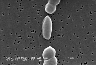 Magnified View of Vibrio parahaemolyticus