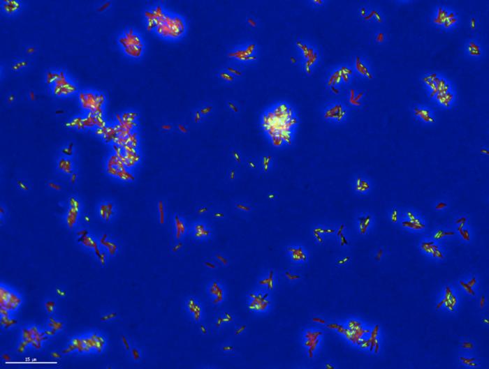 A “death portrait” of TB bacteria treated with an antibiotic and stained to show physical features of individual cells.