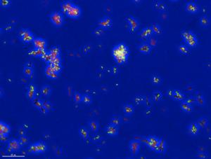 A “death portrait” of TB bacteria treated with an antibiotic and stained to show physical features of individual cells.