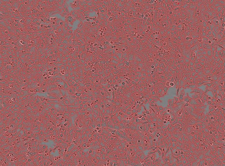 Cancer Cells.